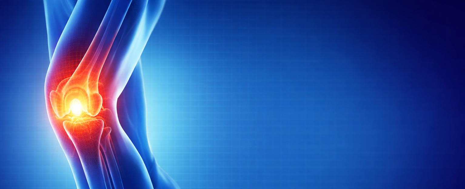 Травмы боковых связок колена